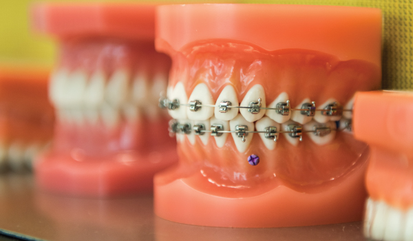 Orthodontics Department